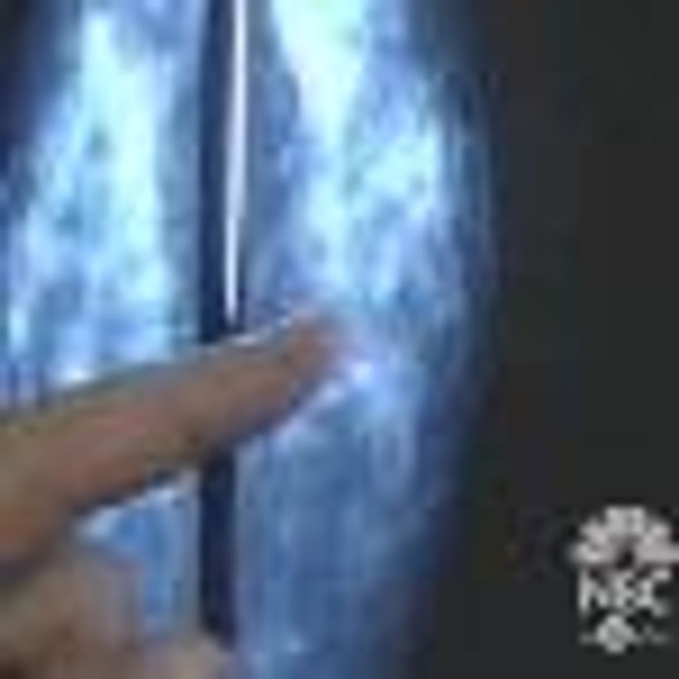 NBC on SheWired: Hormone Breast Cancer Risk - Video